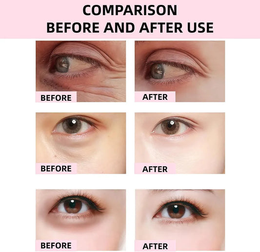 AMA PDRN Collagen Eye Patch with Niacinamide – 60pcs