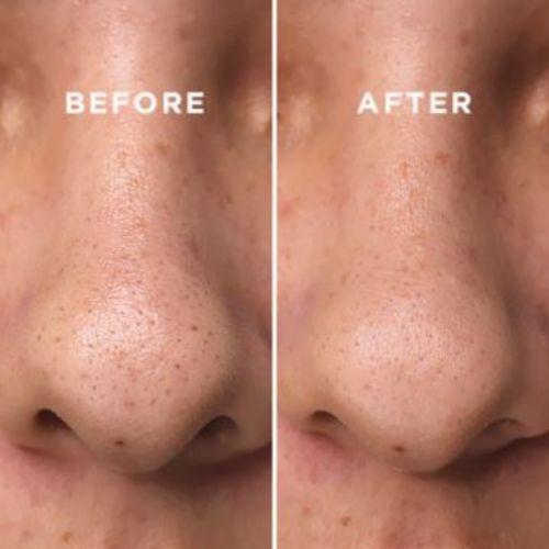 COSRX BHA Blackhead Power Liquid 100ml