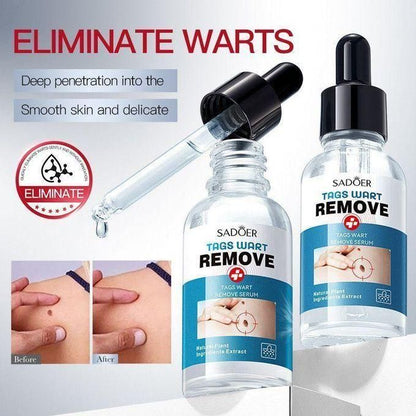 SADOER - Tags Wart Removal Serum 30ml