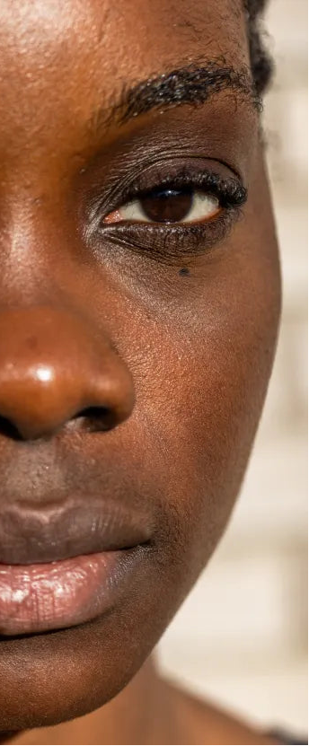 Pigmentation & Dullness