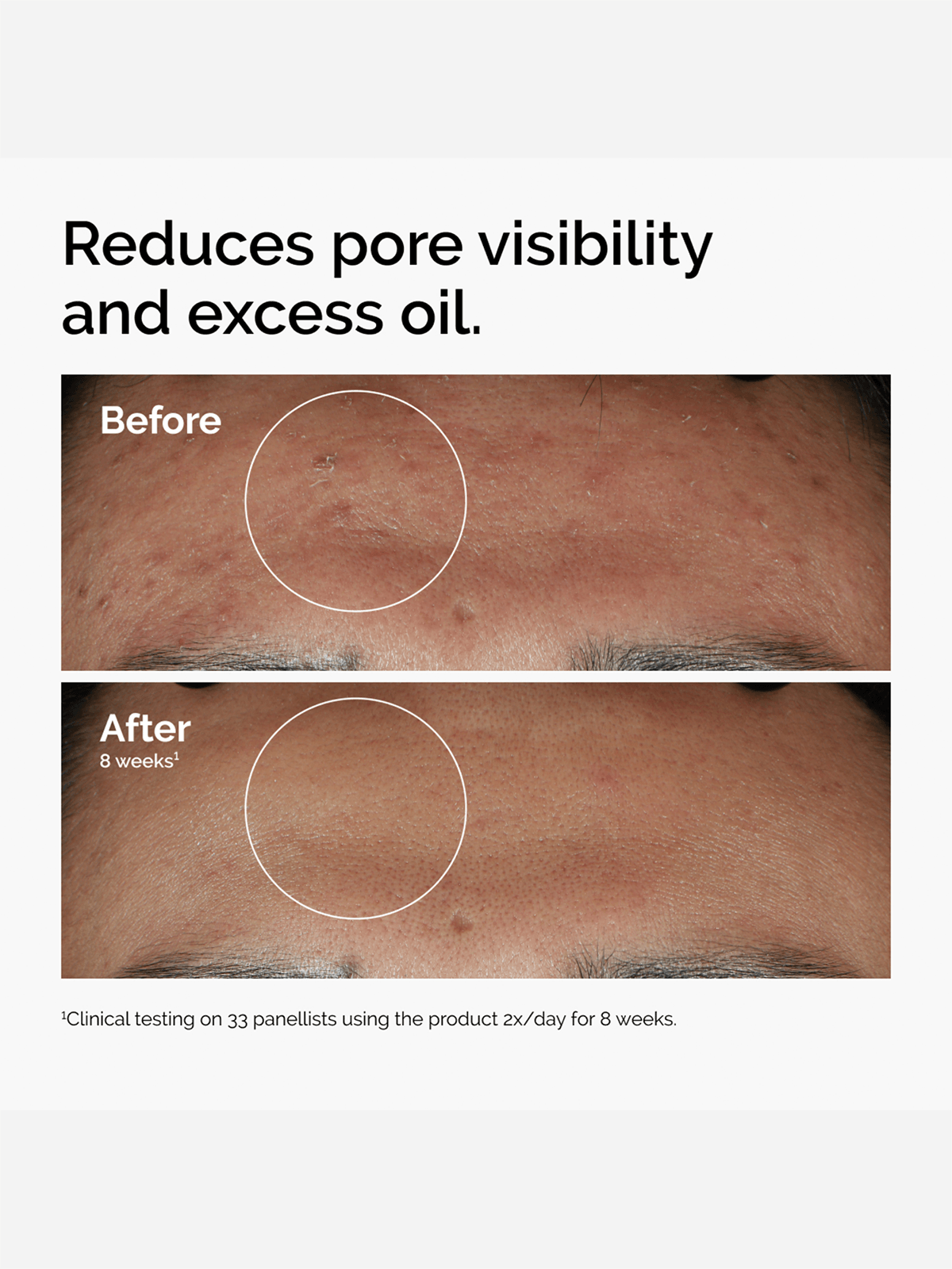 The Ordinary Niacinamide 10% + Zinc 1%