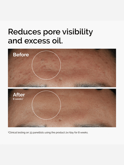 The Ordinary Niacinamide 10% + Zinc 1%