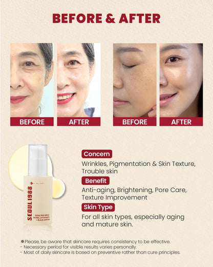 Seoul 1988 Retinal Liposome 2% + Black Ginseng