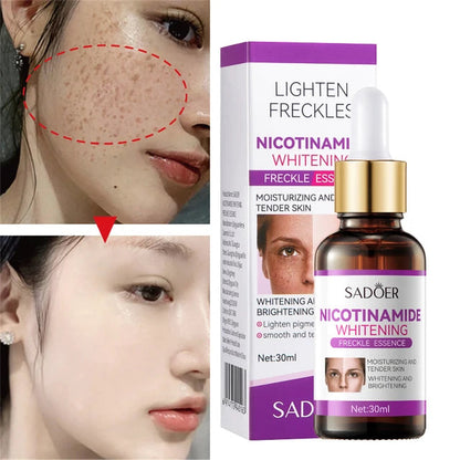 SADOER Nicotinamide Freckle Face Serum – Whitening & Brightening – 30ml