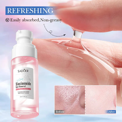 Nicotinamide Spot Removal Serum for Brightening & Hydrating 35ml – SADOER