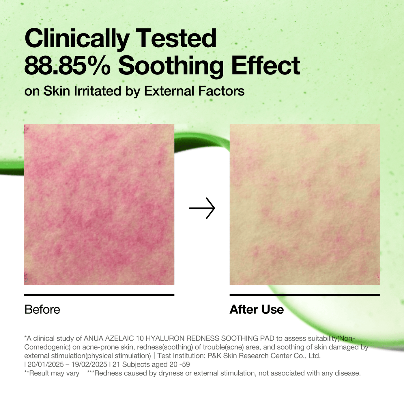 Anua Azelaic 10 Hyaluron Redness Soothing Pad 90 pads