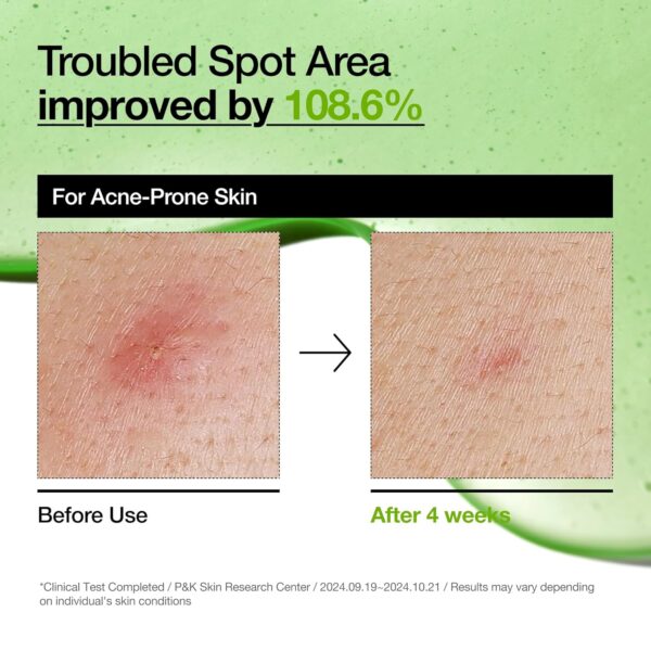 ANUA Azelaic Acid 10 Hyaluron Serum