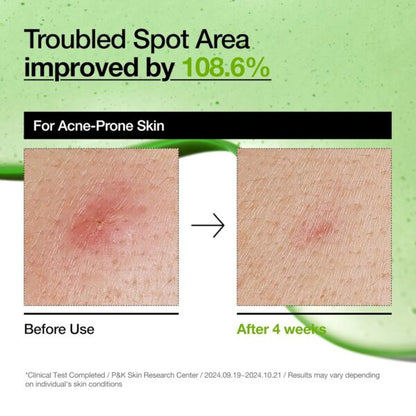 ANUA Azelaic Acid 10 Hyaluron Serum