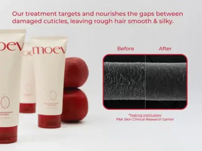 moev annurcatin Treatment 200m