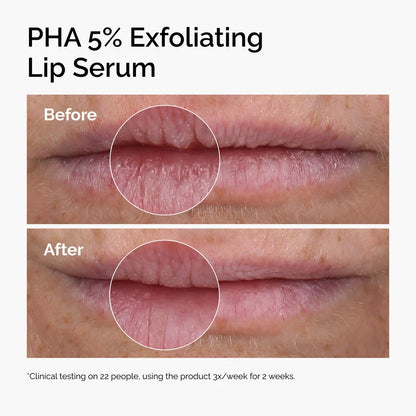 The Ordinary PHA 5% Exfoliating Lip Serum 15ml