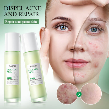Sadoer Salicylic Acid Face Lotion 100ml