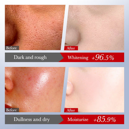 SADOER Kojic Acid Whitening Freckles Toner 120ml