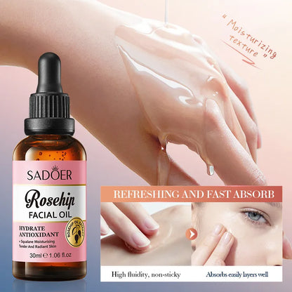 Rosehip Antioxidant Serum for Hydration & Protection – SADOER