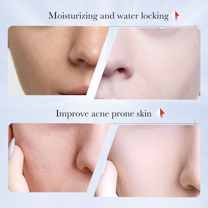 SADOER Kojic Acid Whitening Freckles Body Lotion 250g