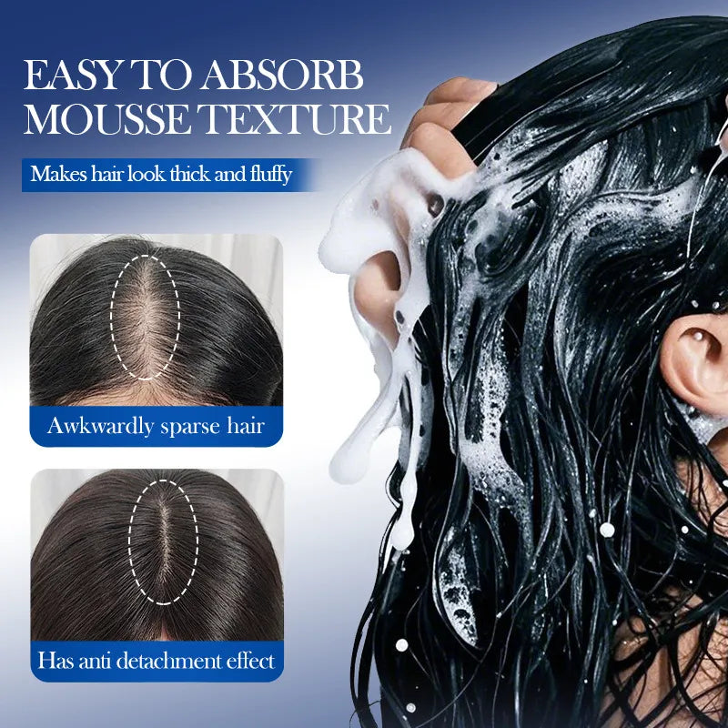 5% Minoxidil Biotin Hair Growth Foam for Thicker Hair – SADOER