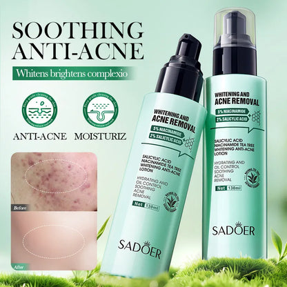 Salicylic Acid Acne Lotion for Moisturizing and Treatment by SADOER