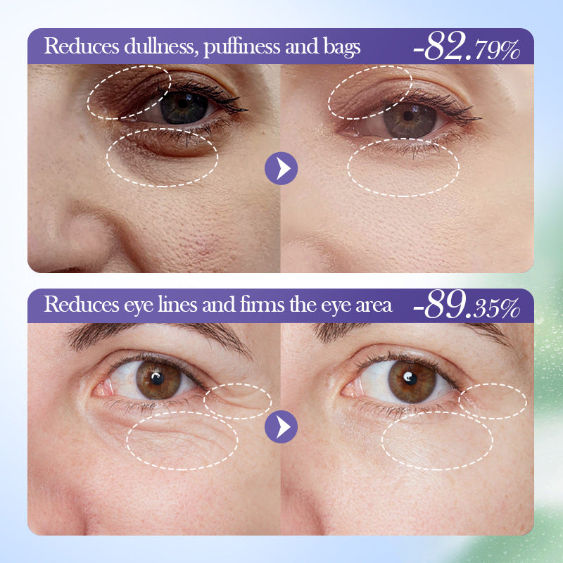 SADOER Blueberry Eye Cream 20g